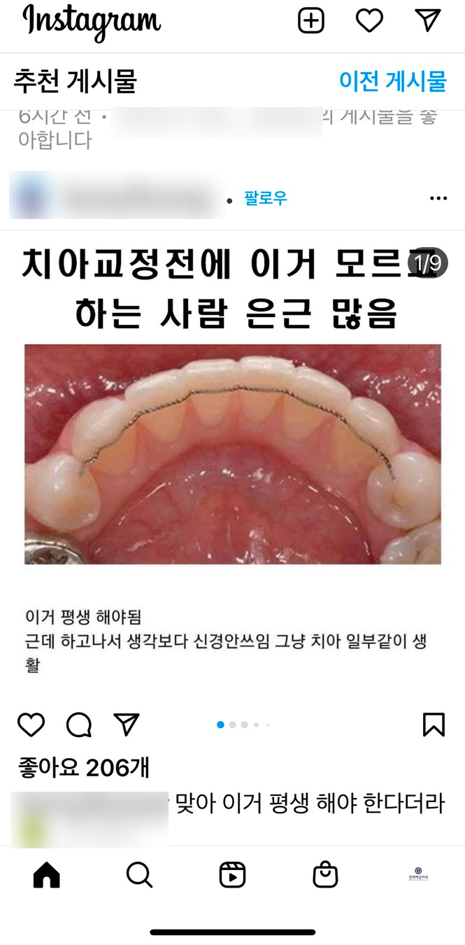 교정을 했었는데 앞니가 삐뚤어졌어요 &rarr;앞니 부분교정(재교정)사례. 2022 이벤트비용안내 관련 이미지 1