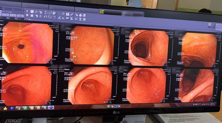 종합건강검진/강북삼성병원 서울종합검진센터 가는길/종합건진센터/연세예감치과 스케일링 안내 관련 이미지 1