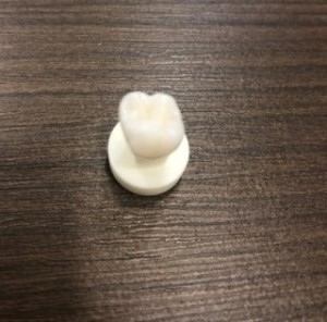 시청역치과/ 연세예감치과에서 "지르코니아 크라운" 알려드려요 관련 이미지 7