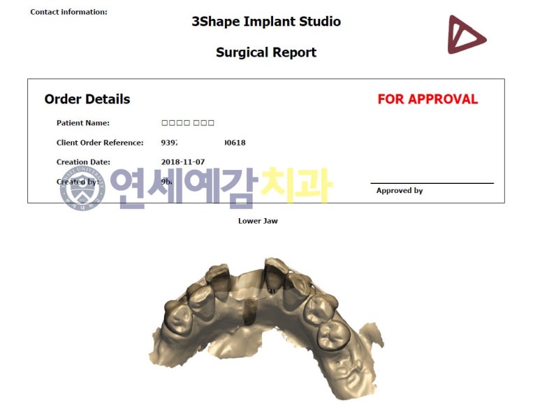 시청역 연세예감치과 디지털임플란트우수시술병원 선정 & 네비게이션 임플란트 관련 이미지 5