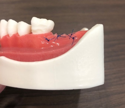시청역 연세예감치과 디지털임플란트우수시술병원 선정 & 네비게이션 임플란트 관련 이미지 3