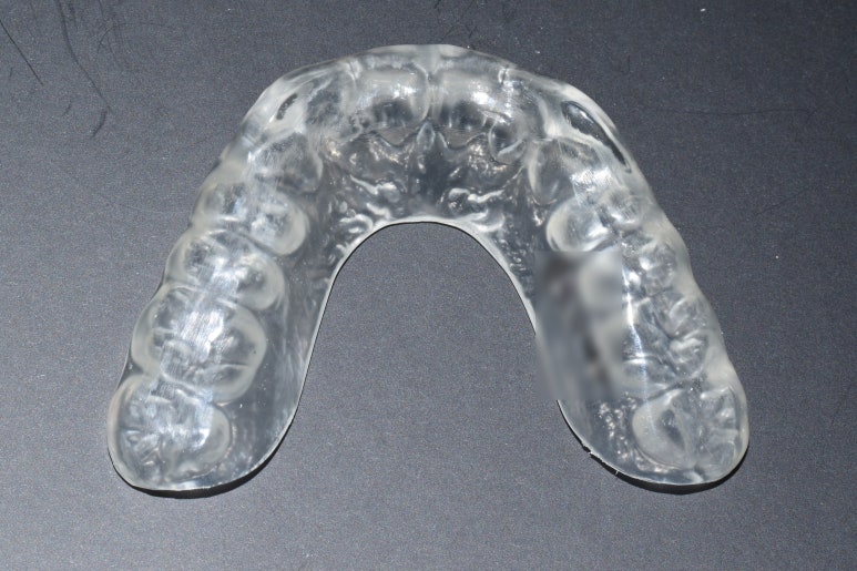 이갈이를 고치는 방법, 나의 치아보호를 위해서 그리고 남을 배려하기 위해서 관련 이미지 5