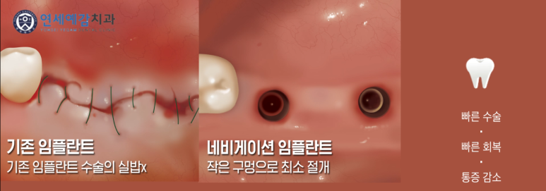 무통마취기 보유하고 있는 시청역, 광화문, 충정로 가까운 치과 관련 이미지 7