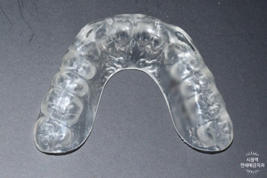 [시청역,서울역/치과] 개개인 맞춤형 치과제작 이갈이 장치로 이를 보호하세요& 비용,가격 정보 관련 이미지 6