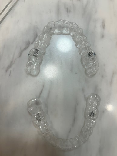 시청역, 서울역,광화문역 외국인도 찾는 투명교정 브랜드 인비절라인이벤트 가격공개! 관련 이미지 13