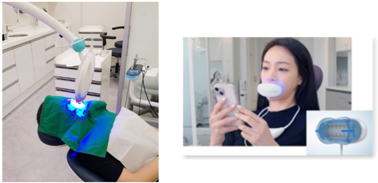 서울시청 용산 치아미백 잘 하는 치과, 예비신랑신부, 외국인, 교포들이 일부러 치아미백하러 찾아오는 치과 관련 이미지 3