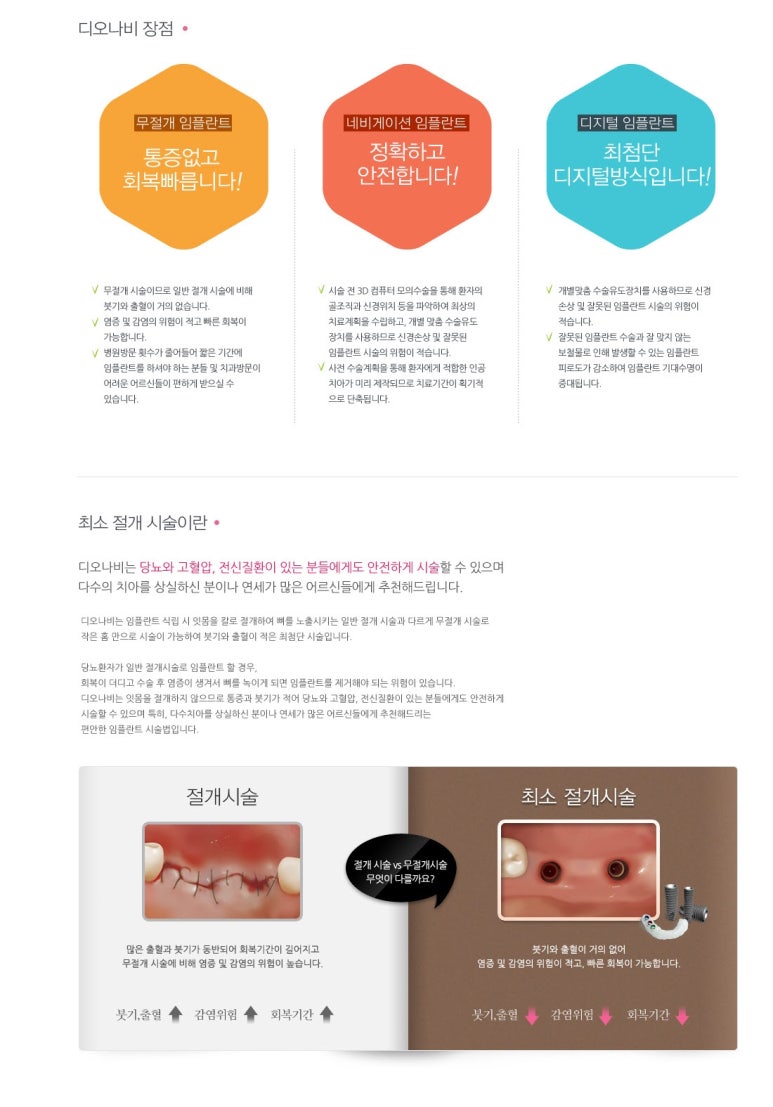 [북창동 치과/연세예감치과]내비게이션임플란트소개 관련 이미지 29