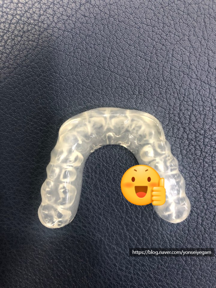 [서울역/광화문]이갈이 심하다면? 이갈이보톡스 어떠세요? 이갈이 보톡스, 이갈이 장치 관련 이미지 5