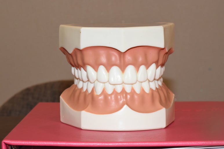 아주 하얀 치아를 만들고 싶어요 라미네이트케이스 및 비용 안내 관련 이미지 5