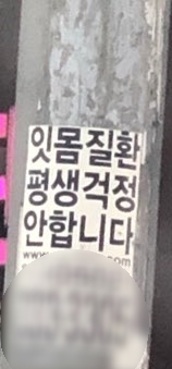 잇몸질환 평생 걱정안합니다??? 관련 이미지 2