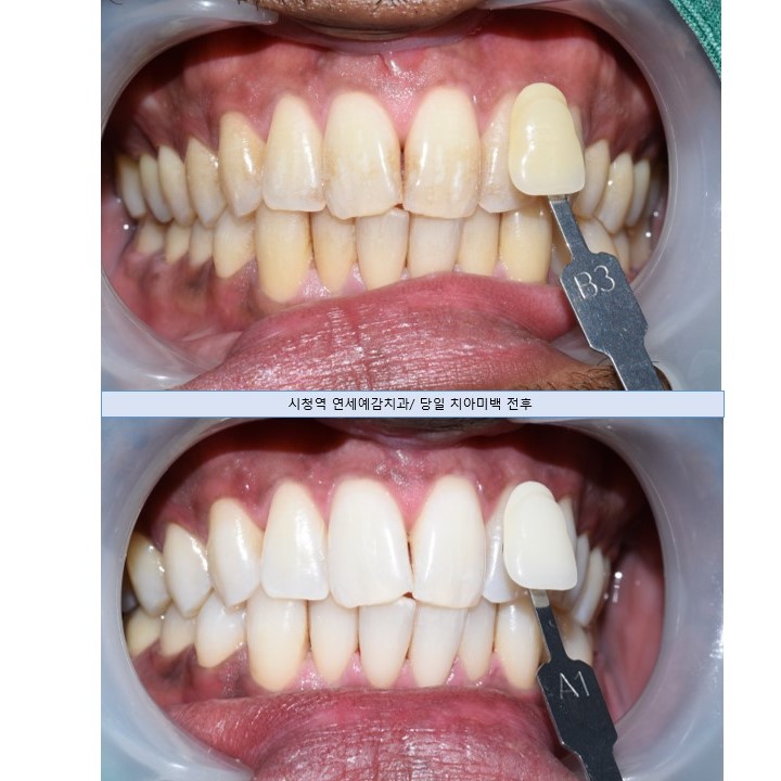 외국인치과 해외에서도 치과공포증환자들이 찾아오는 치과입니다. 관련 이미지 10
