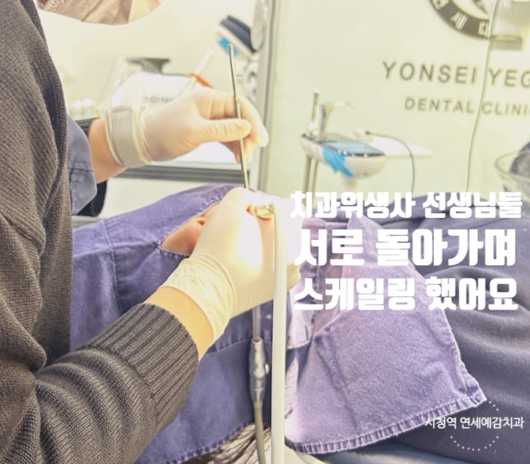 시청역/을지로 치과 가글마취 스케일링 가능해요! (+스켈링 소리동영상) 관련 이미지 1