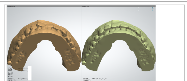 서울역 치과 투명교정 실제사례,비용가격 알아볼까요? 관련 이미지 3