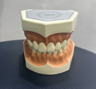 투쓰젬(Tooth gem),굳이 한다면 꼭 치과에서! 이유&비용,실제 치과에서 한 사진까지! 관련 이미지 4