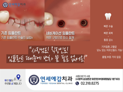 충정로 내비게이션 임플란트 알려드려요 관련 이미지 1