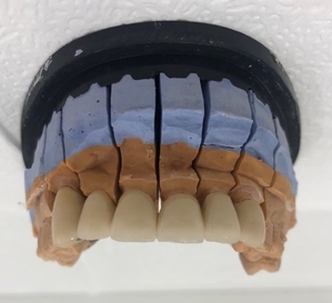 시청역치과 벌어진 앞니를 바르고 이쁘게! 대한심미학회회원치과 관련 이미지 8