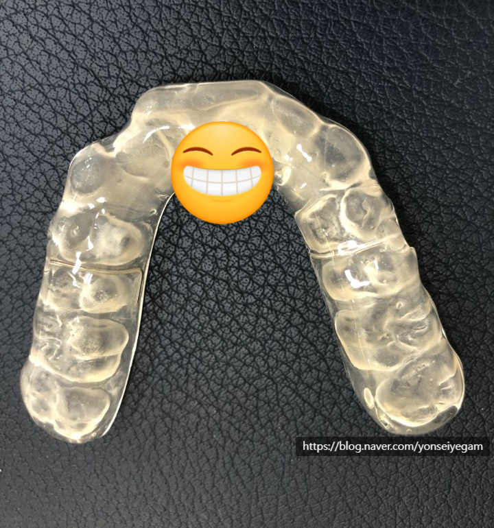 [서울역/광화문]이갈이 심하다면? 이갈이보톡스 어떠세요? 이갈이 보톡스, 이갈이 장치 관련 이미지 4