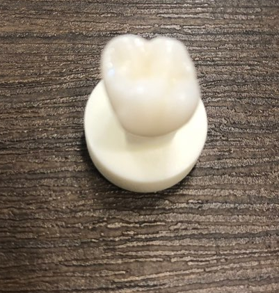 해외에서도 찾아오는 [시청역 연세예감치과]에서 알려드리는 지르코니아크라운 관련 이미지 3