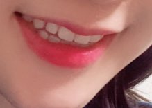 치과의사는 가족에게는 라미네이트 안한다고요? 저희 치과의사선생님은 본인 이에 직접 "프리네이트"하셨어요! 관련 이미지 6