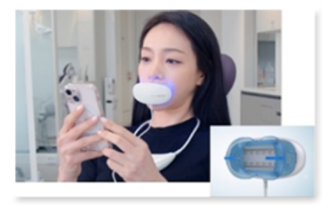 홍대치아미백 찾고 계신다면 해외관광객도 미백하러 찾아오는 치과 얼마일까요 관련 이미지 3