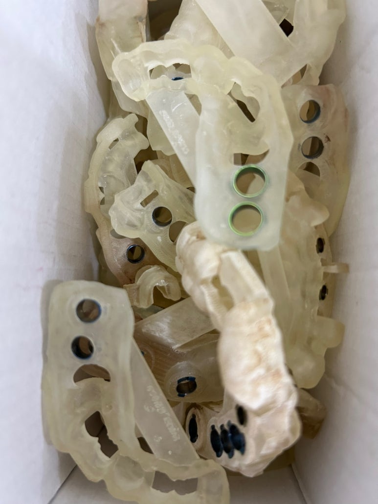 마포 임플란트가 너무 무서워요 하는 분들 잇몸절개하지 않는 네비게이션임플란트 소개해드립니다 관련 이미지 19