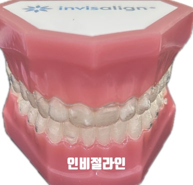 시청역 연세예감 치과 환자분께서 투명교정 후기 남겨주셨어요 관련 이미지 3