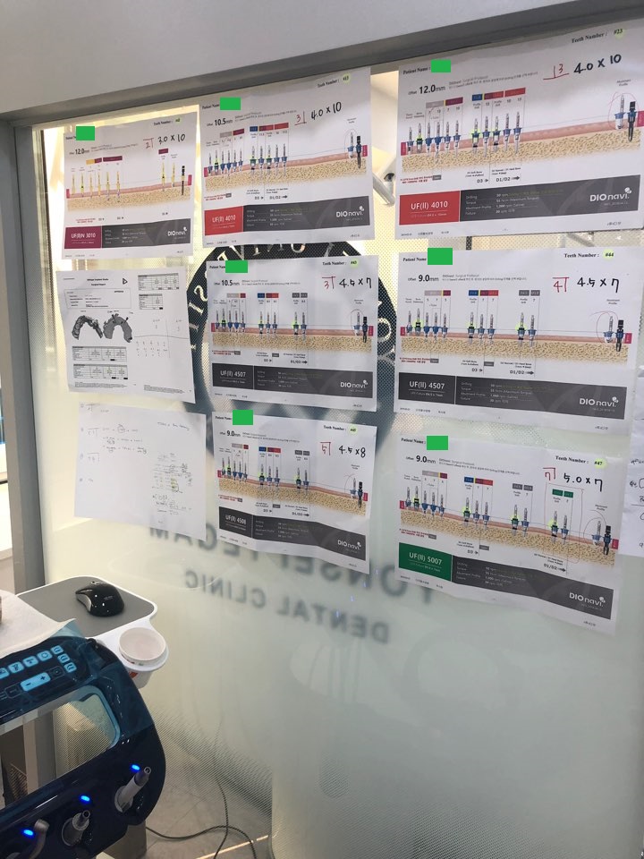[서울시청역치과] 20대, 30대도 임플란트를 하나요?? +네비게이션임플란트안내 관련 이미지 7