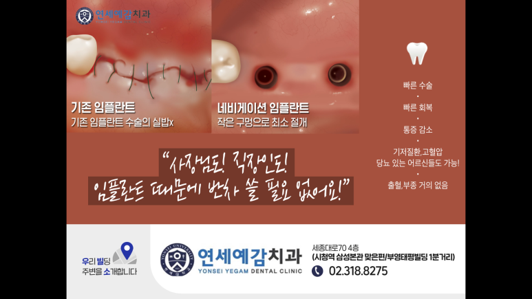 서울역 서울시청역 내비게이션인플란트 유명한 치과 관련 이미지 5