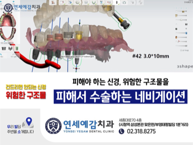 충정로 내비게이션 임플란트 알려드려요 관련 이미지 2