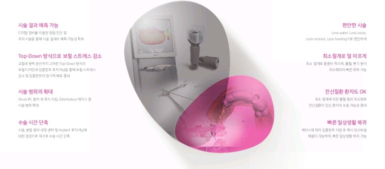 [광화문임플란트]임플란트 많이 아픈가요? 겁이 많아요 -네비게이션 임플란트 사례 관련 이미지 2