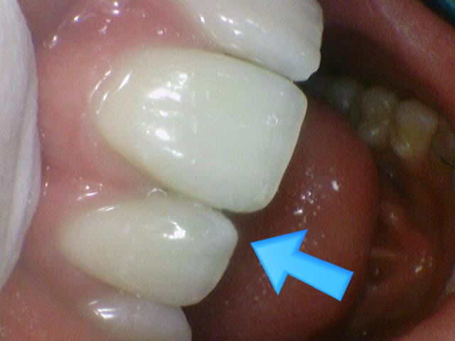외국인치과 해외에서도 치과공포증환자들이 찾아오는 치과입니다. 관련 이미지 8