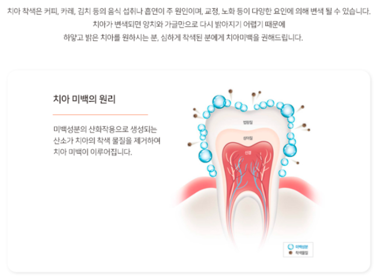 시청역 휴대폰하면서 편하게 미백 치과전용목걸이형 미백기 보유 관련 이미지 6