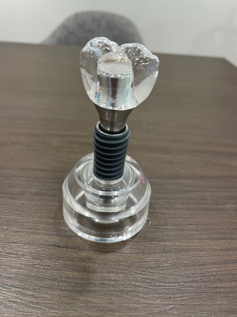 [서울시청역치과] 다른 치과에서 오래전에 한 임플란트가 흔들려요 &rarr;재수술 케이스 관련 이미지 2