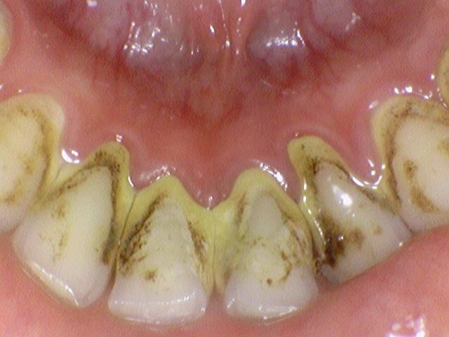 광화문역 스케일링 만19세이상 국민이면 누구나 혜택 관련 이미지 3
