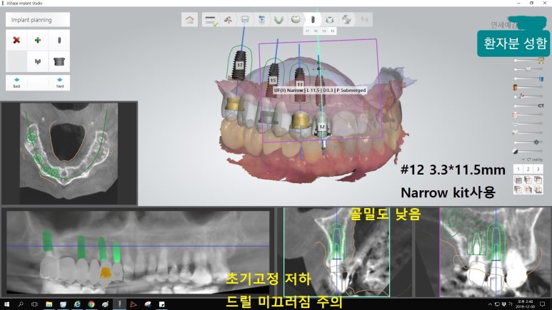 [시청역/을지로] 임플란트 진단 상담 비용? 관련 이미지 11