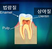 시청역치과 양치질을 할 때 칫솔이 닿으면 시려요 케이스 관련 이미지 1
