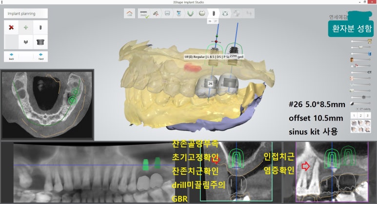 [시청역/을지로] 임플란트 진단 상담 비용? 관련 이미지 12