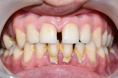 광화문역 스케일링 만19세이상 국민이면 누구나 혜택 관련 이미지 2