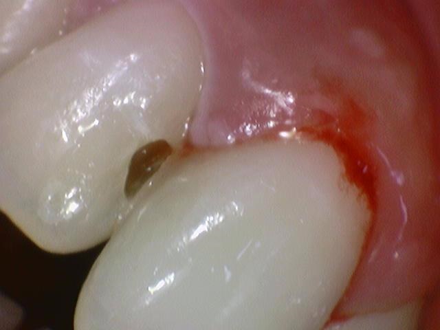 외국인치과 해외에서도 치과공포증환자들이 찾아오는 치과입니다. 관련 이미지 3