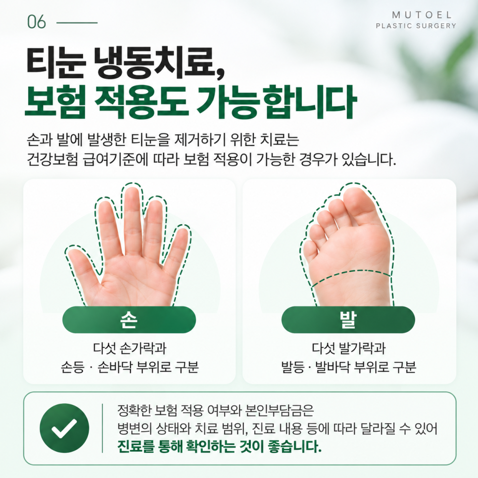 손, 발에 생긴 티눈 냉동치료로 제거할 수 있을까? 보험 적용까지 알아보기 관련 이미지 6