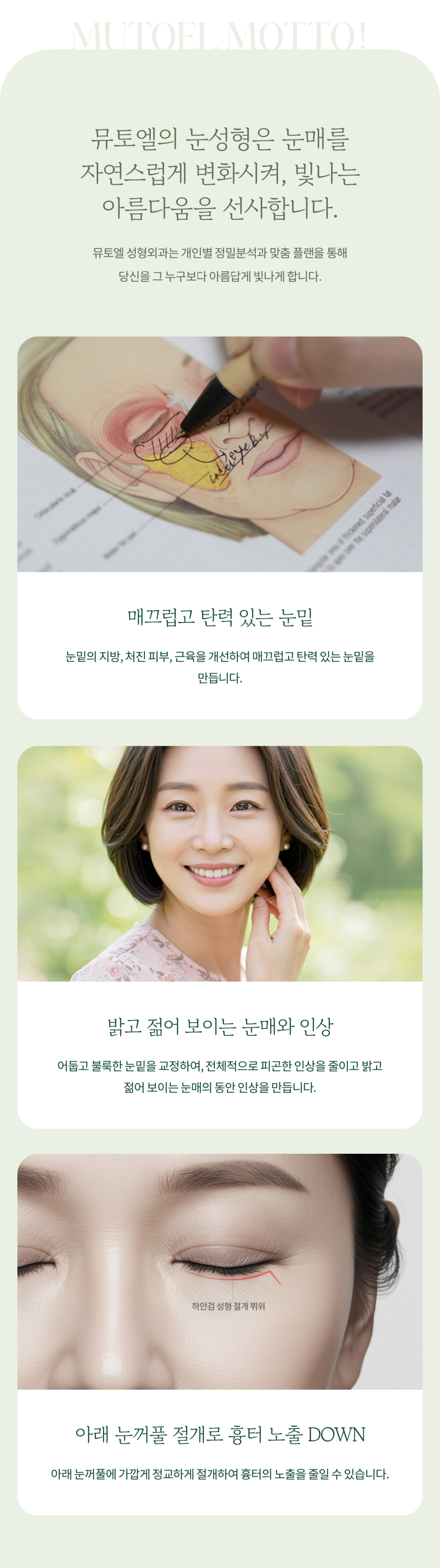 Improving the Under-Eye Area to Make the Eyes Look Younger at Sinyongsan Plastic Surgery image 5