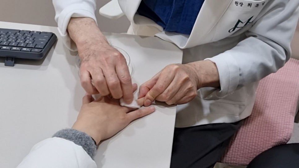Cryotherapy Review for Finger Warts and a Video of the Actual Treatment Process Included image 8