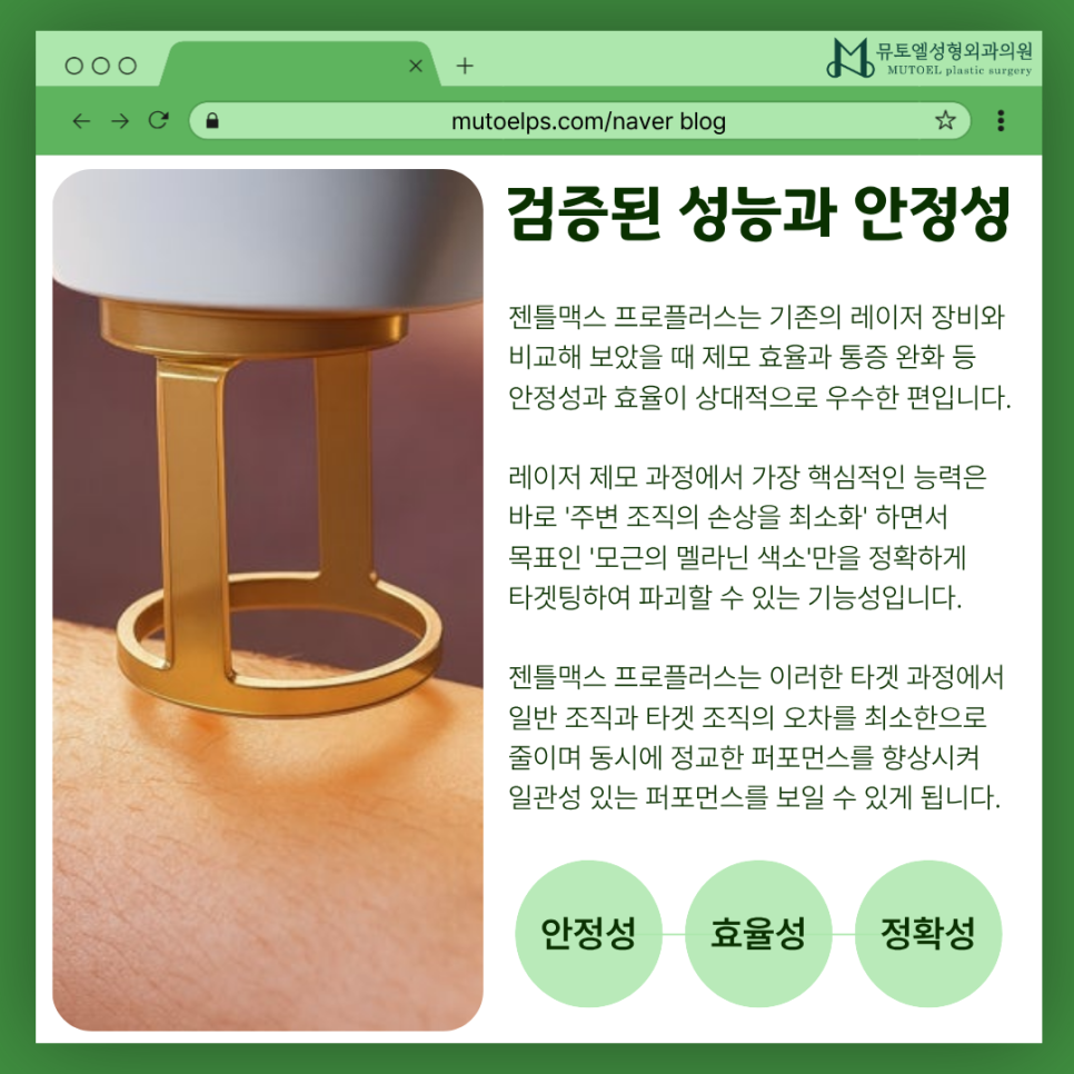 아침마다 반복되는 제모 스트레스, 전문의가 직접 경험한 젠틀맥스 프로플러스 관련 이미지 3