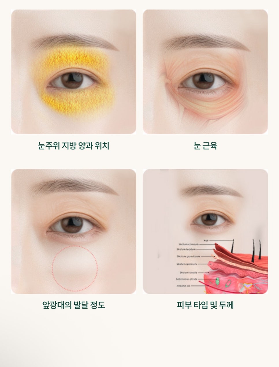 눈썹하거상 부작용이 걱정된다면 관련 이미지 7