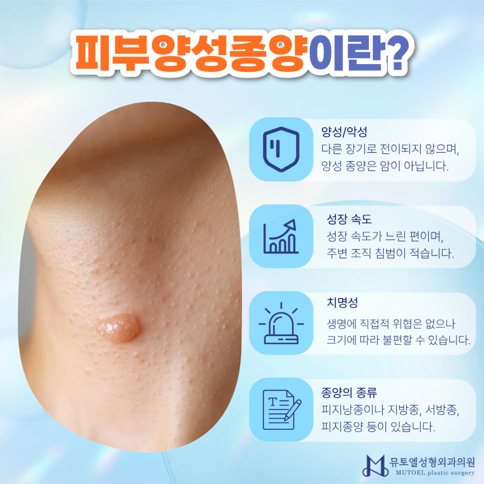 Skin Benign Tumors: Characteristics by Type and a Professional Guide to Accurate Treatment image 2