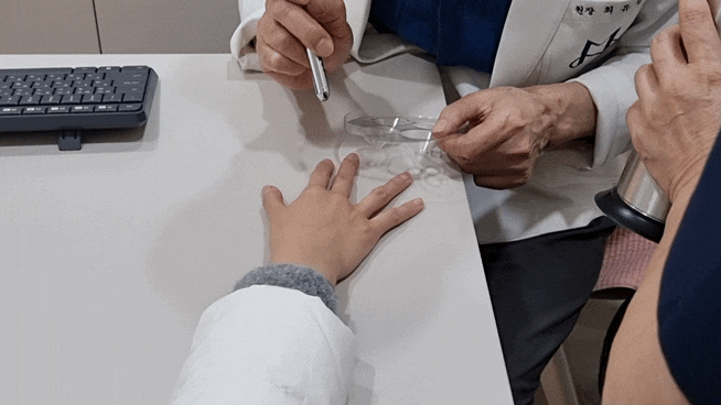 Cryotherapy Review for Finger Warts and a Video of the Actual Treatment Process Included image 9