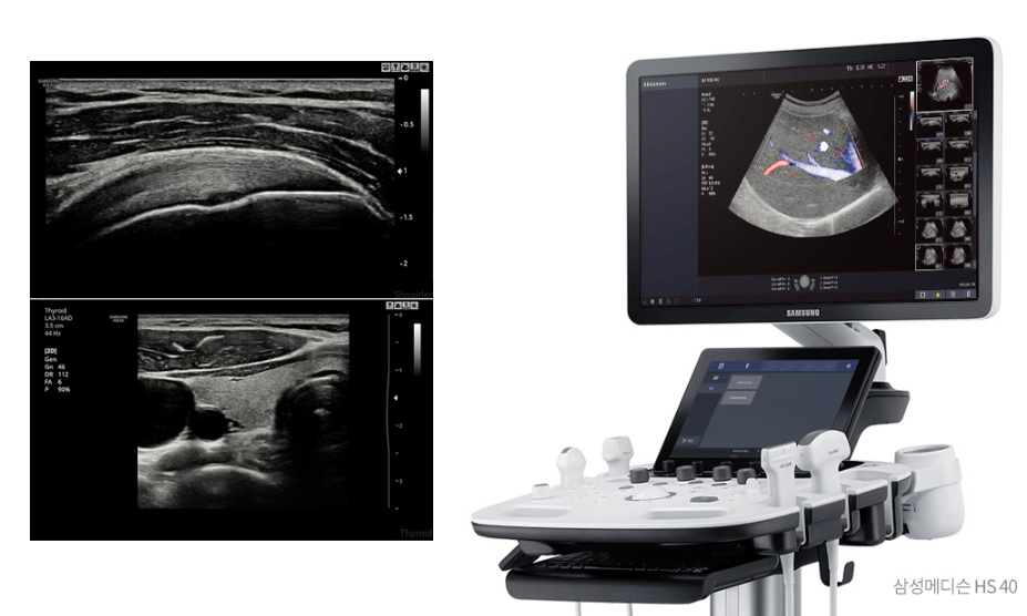 What Is the Key to Removing Benign Skin Tumors Near Yongsan Station? image 11