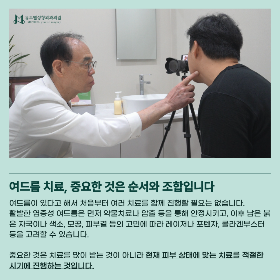 여드름 치료, 먹는 약부터 압출·포텐자·레이저까지 알아보기 관련 이미지 5