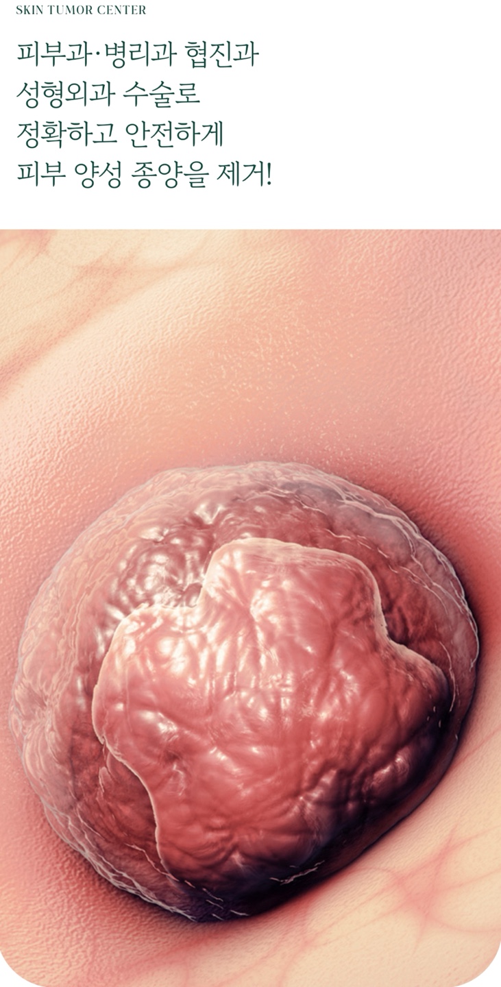 What Is the Key to Removing Benign Skin Tumors Near Yongsan Station? image 1