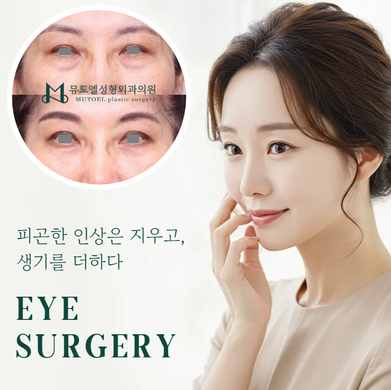 Under-Eye Fat Repositioning and Lower Blepharoplasty: A Choice That Improves Your Impression image 1